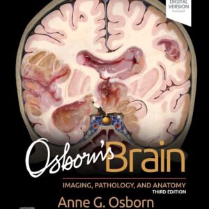 Osborns Brain Imaging, Pathology and Anatomy medical book