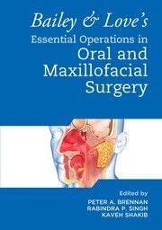 Bailey And Loves Essential Operations in Oral and Maxillofacial Surgery dental book