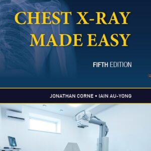 Chest X Ray Made Easy medical book