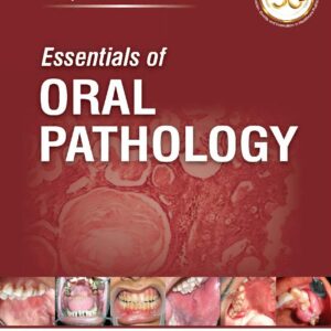 Essentials of Oral Pathology medical book