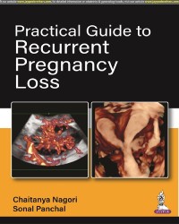 Practical Guide to Recurrent Pregnancy Loss medical book