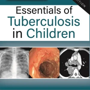 Essentials of Tuberculosis in Children medical book