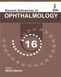 Recent Advances in Ophthalmology medical book