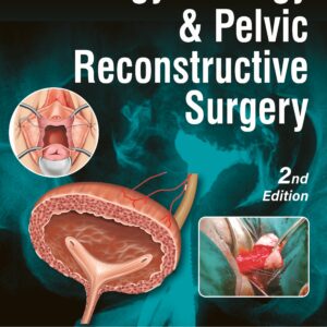 Urogynecology and Pelvic Reconstructive Surgery medical book