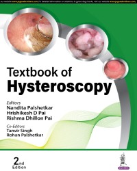 Textbook of Hysteroscopy medical book