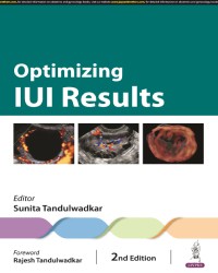 Optimizing IUI Results medical book