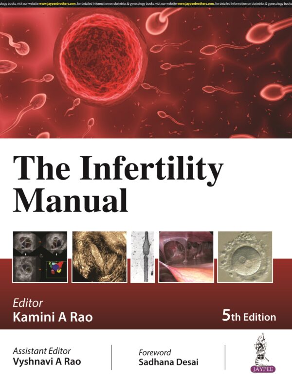 Infertility Manual medical book