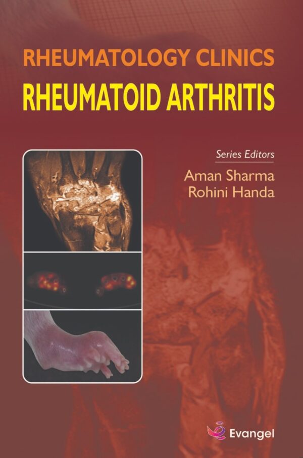 Rheumatology Clinics Rheumatoid Arthritis medical book