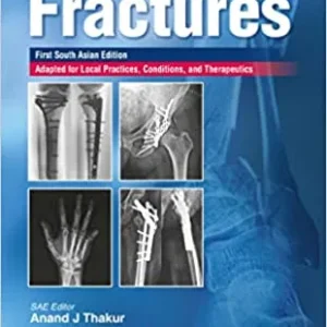 Handbook of Fractures medical book