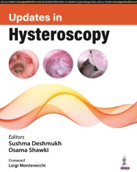 Updates in Hysteroscopy medical book