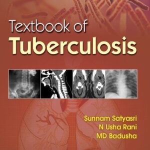 Textbook Of Tuberculosis medical books