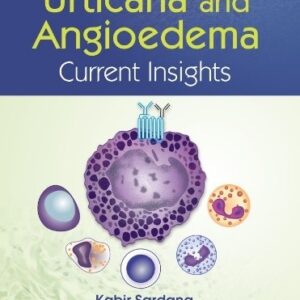 Urticaria And Angioedema Current Insights medical books