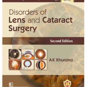 Disorders of Lens and Cataract Surgery medical books