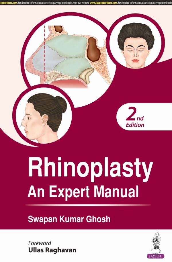 : Rhinoplasty An Expert Manual medical book