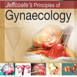 jeffcoates Principles of Gynaecology medical book