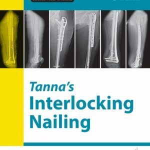 9789356964907 Dr. Tanna Interlocking nailing
