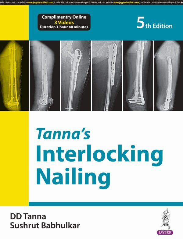9789356964907 Dr. Tanna Interlocking nailing