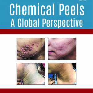 9789352703524 - Chemical Peels 1st 2025 , Just medical Books